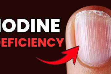 4 Signs of Iodine Deficiency That Show Up in Your Hair, Skin, and Nails