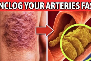 This Morning Glass Unclogs Arteries and Supercharges Blood Flow