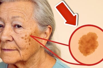 Rub THIS on Your Skin to Erase Age Spots (Incredibly Fast)🤯