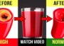 This Habit Will Unclog Arteries Naturally And Control High Blood Pressure