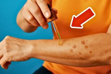 Age spots disappear FOREVER when you rub THIS on your skin 💥
