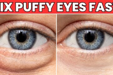 Puffy Eyes? One Kitchen Ingredient Fixes It Fast