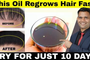 Try This for 10 Days to Stop Hair Fall & Regrow Hair Naturally
