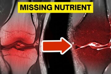 The Forgotten Nutrient That Rebuilds Your Joints