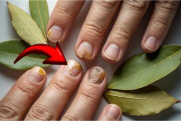 Nail Fungus Cure That Pharmacists Don’t Want You To Know