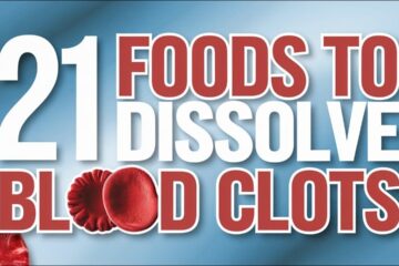21 Superfoods That Naturally Dissolve Blood Clots!